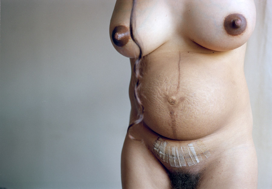    "My belly after giving birth and c section" dalla serie "Mother", Elinor Carucci, 2004 